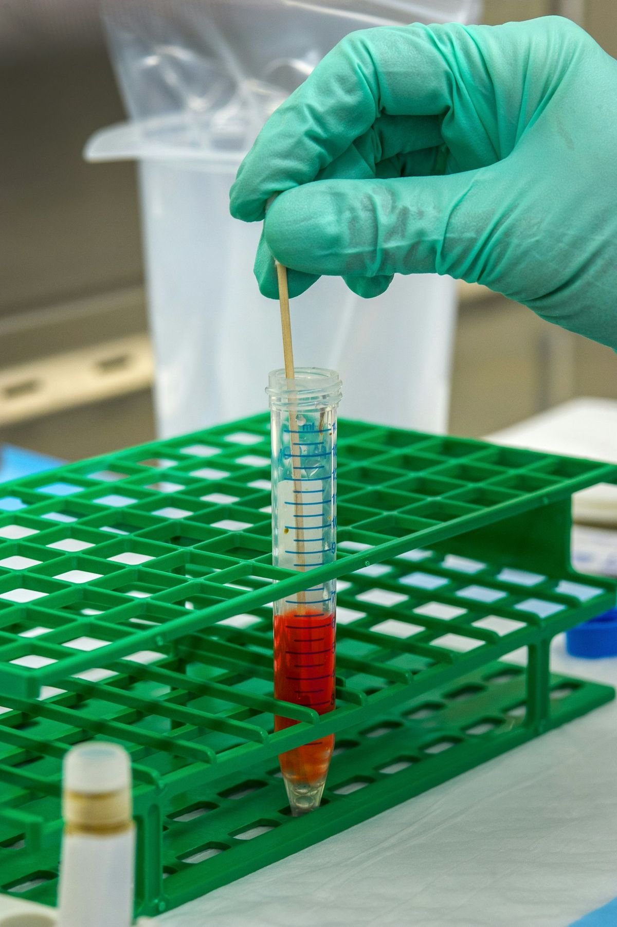 Blodprove i reagensglass paa laboratorium