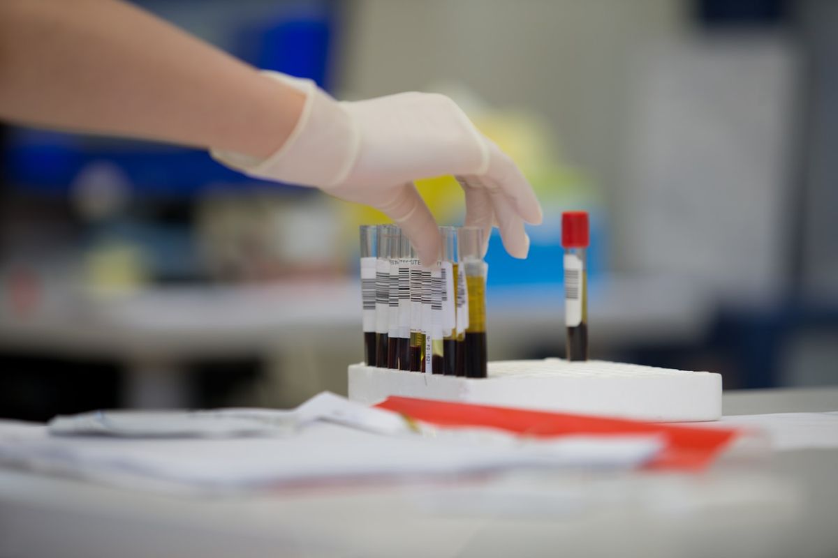 Laboratorieanalyse av blodprove