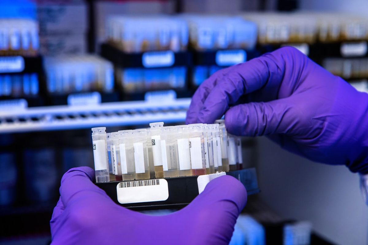 Laboratorieprove og analyse