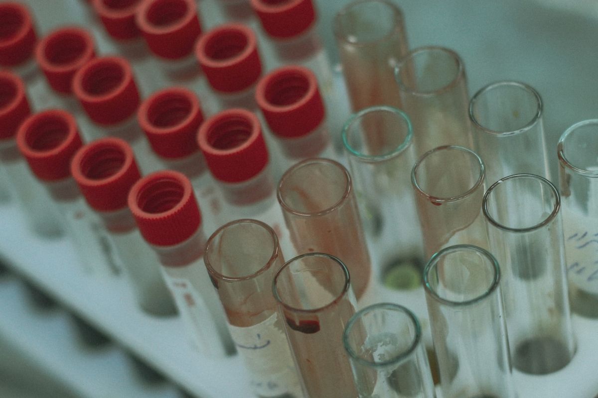 Blodproveror i stativ paa laboratorium