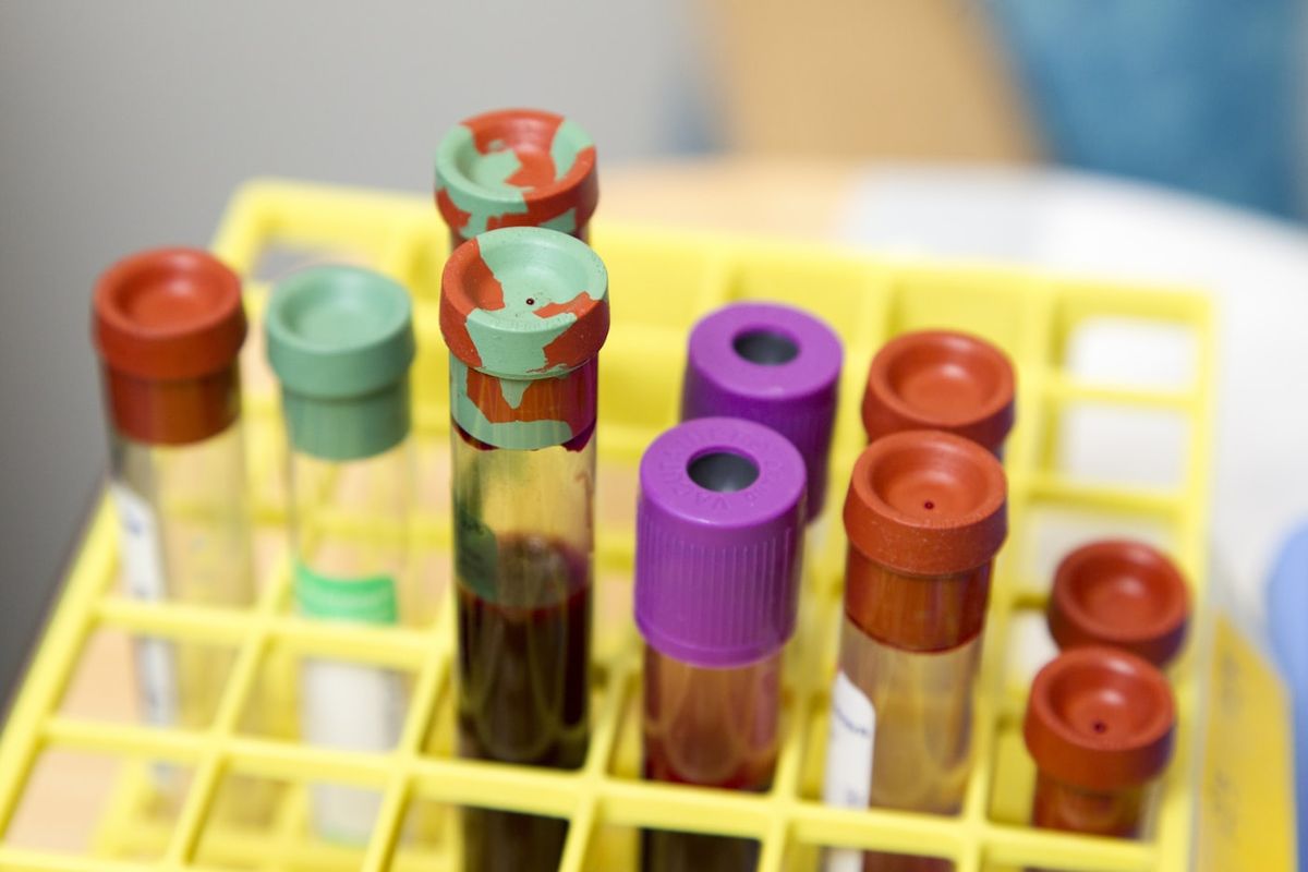 Forsker studerer blodceller i mikroskop pa laboratorium