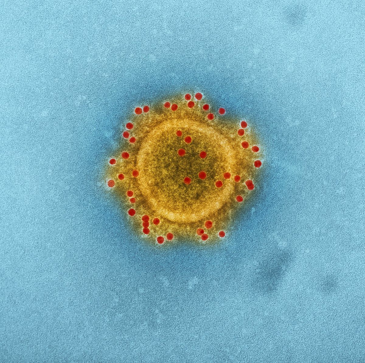 Illustrasjon av virus