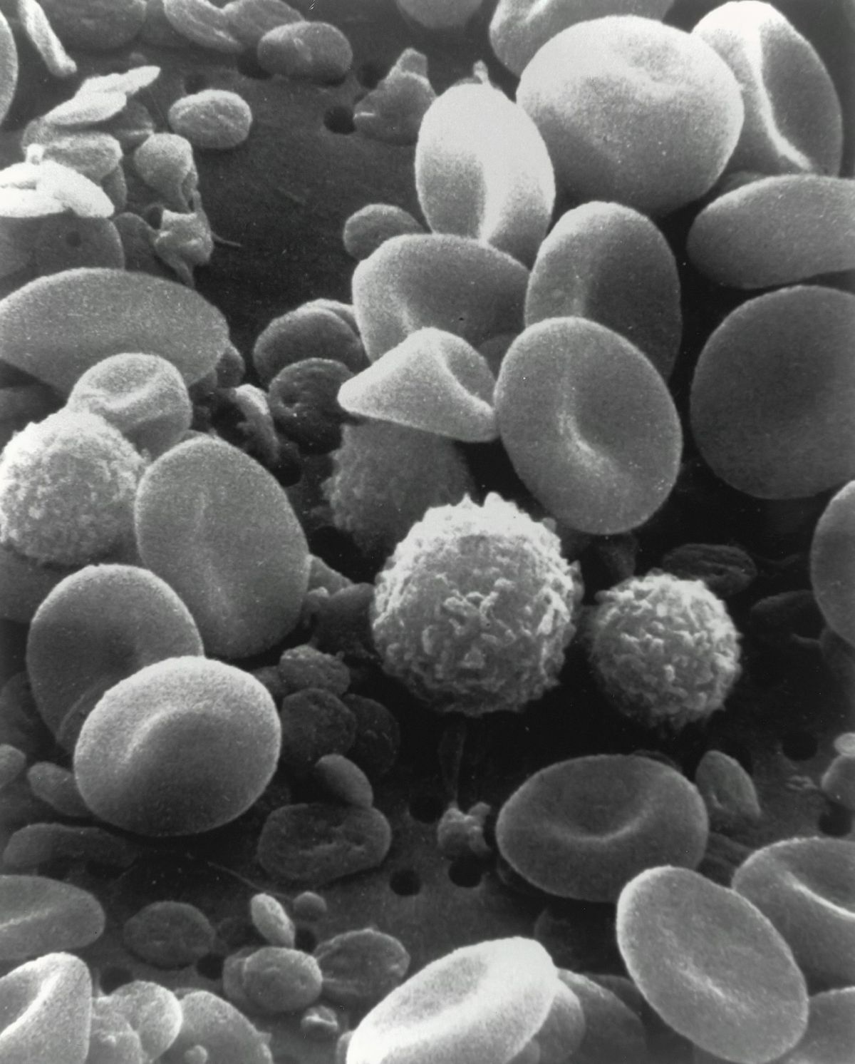Blodceller sett under mikroskop