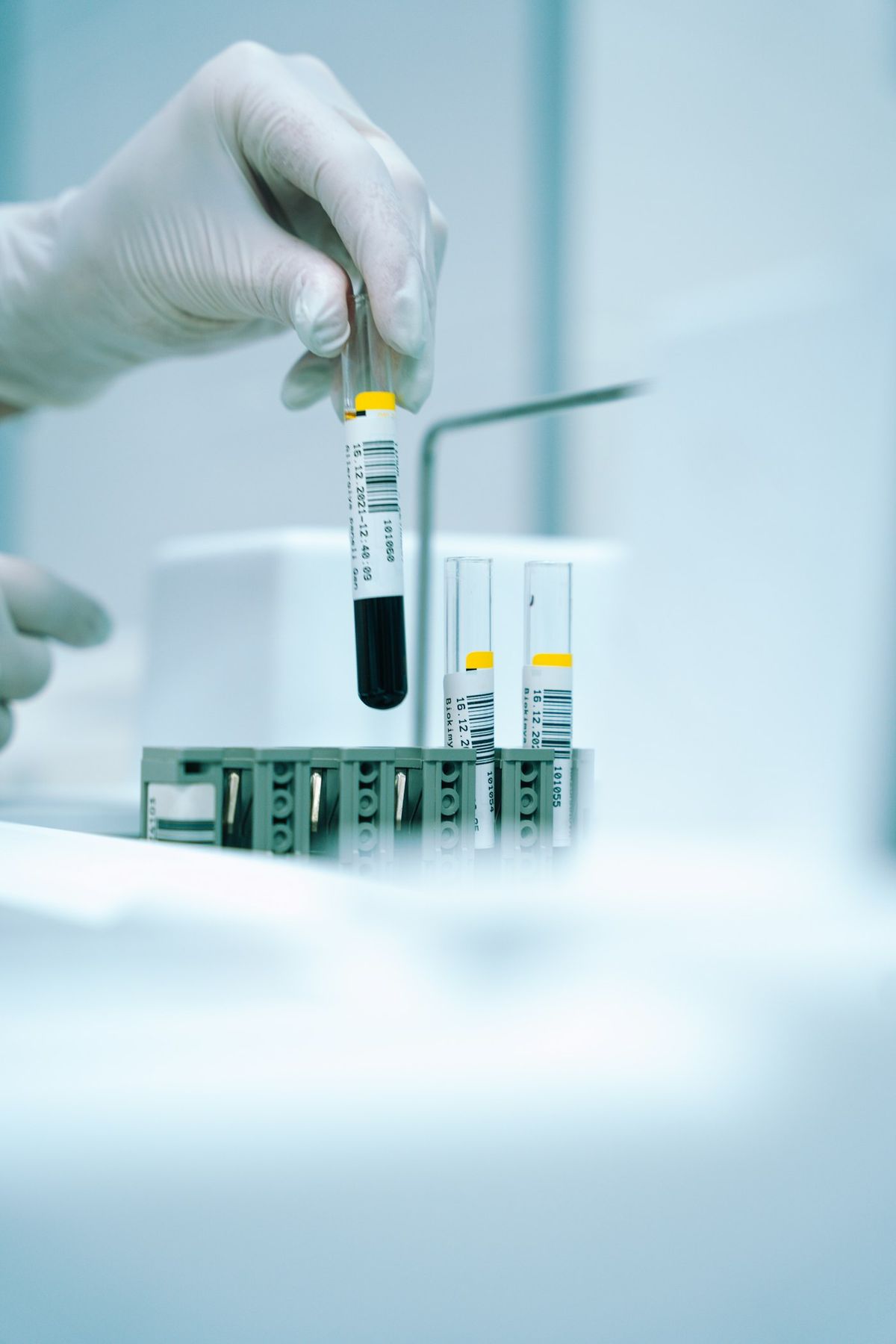 Blodprover i provoror pa laboratorium